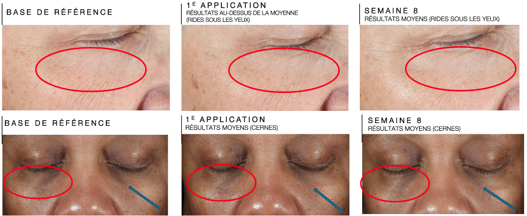 AGE Advanced Eye