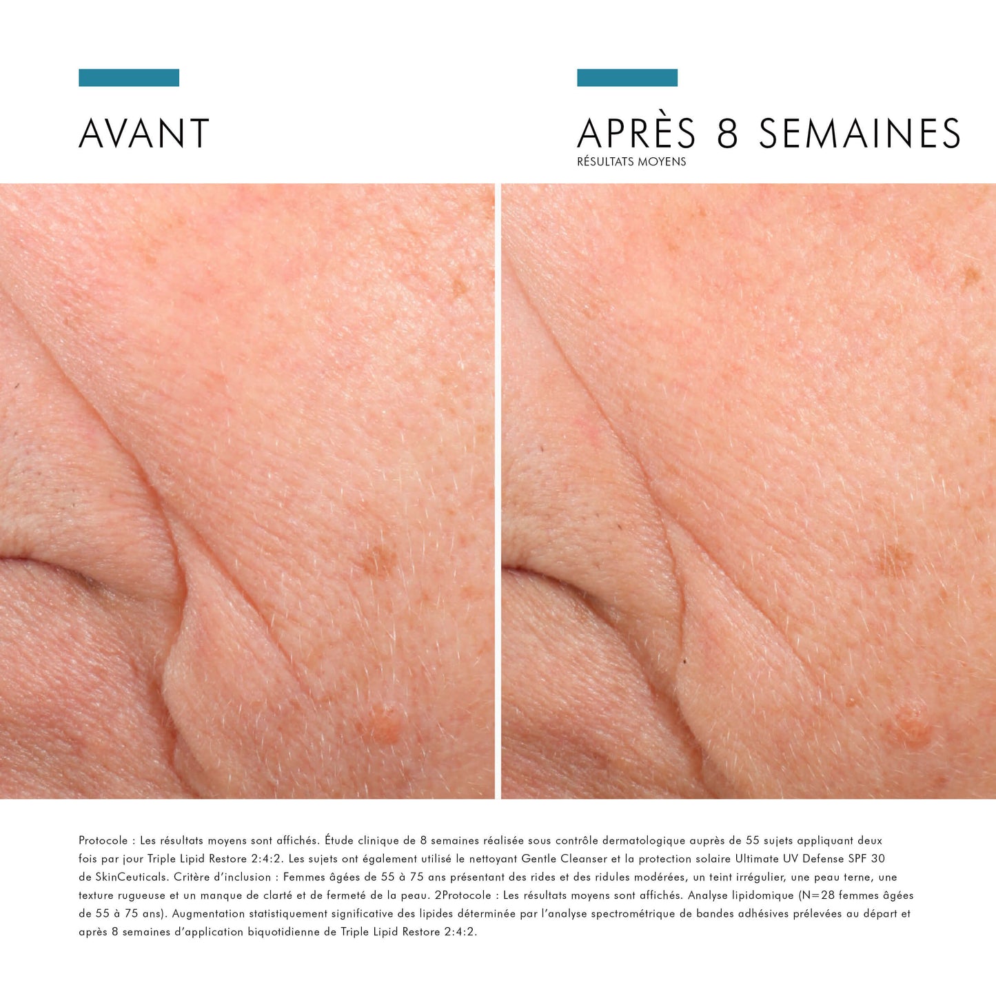 Triple Lipid Restore