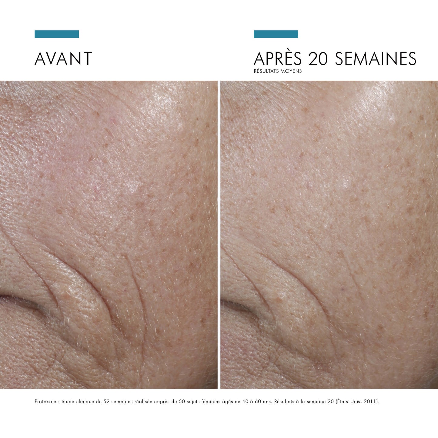 CE Ferulic